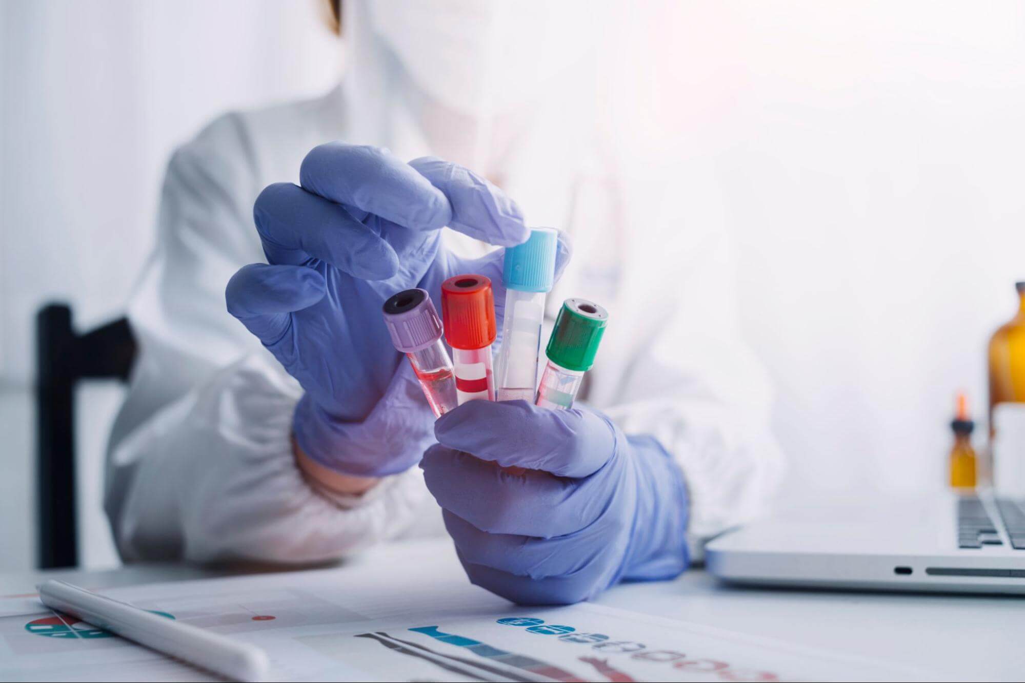 Exame toxicológico para motoristas: quando é necessário?